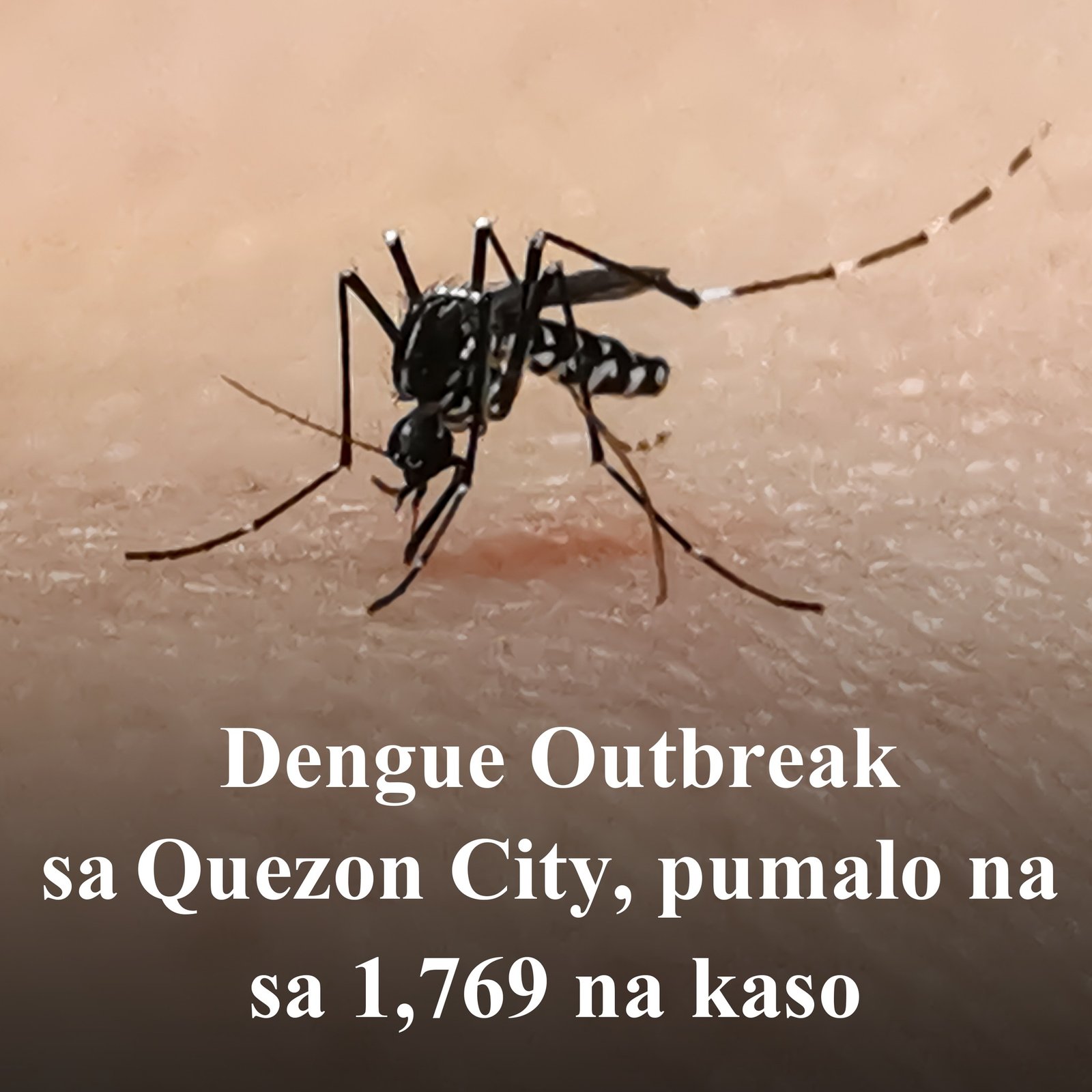 Quezon City Nagdeklara ng Dengue Outbreak